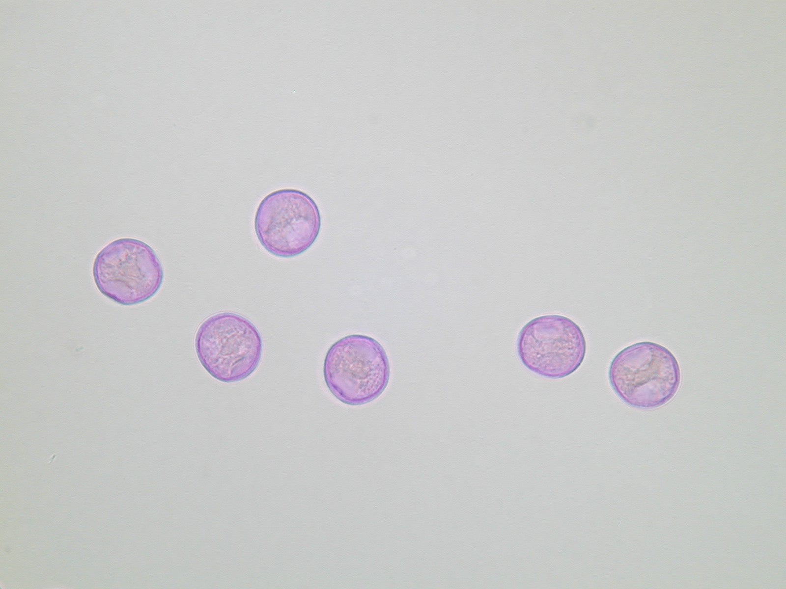 Lichtmikroskopische Aufnahme von mit Fuchsin gefärbten Glaskraut-Pollen (Foto: Landesagentur für Umwelt und Klimaschutz)