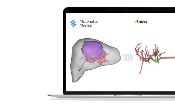 Segmentation and simulation shown in one workflow from the liver on the left and the injection on the right shown on a laptop screen.