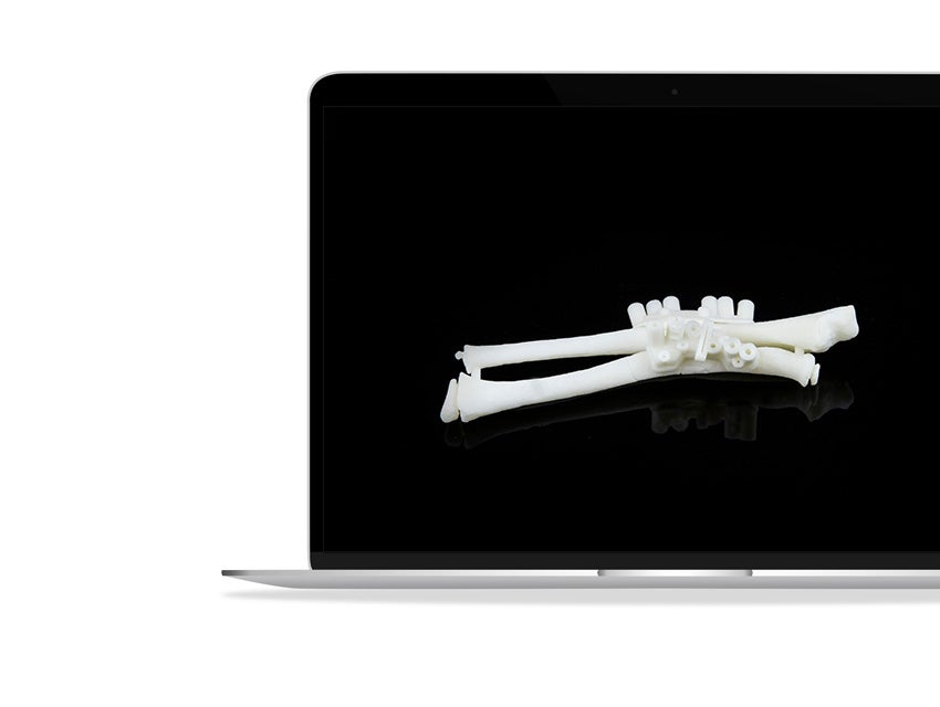 ssd-3d-printed-osteotomies-guides-3d-printed-bones.jpg
