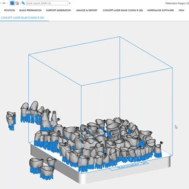 4 Common 3D Printing Challenges for Dental Labs: Why Automation Is the Solution