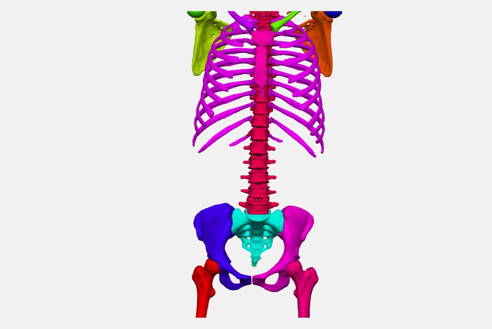 A 3D model of a segmented shoulder, torso, hip, and upper leg anatomy
