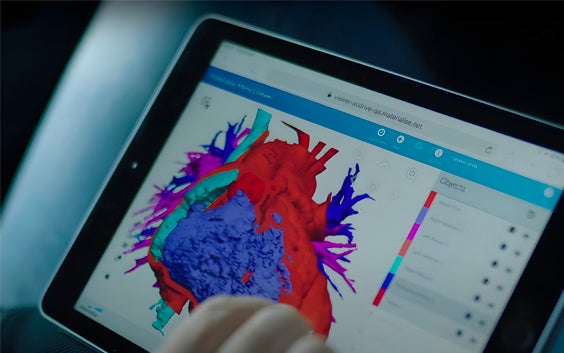 Visual of a heart in SurgiCase open on an ipad.