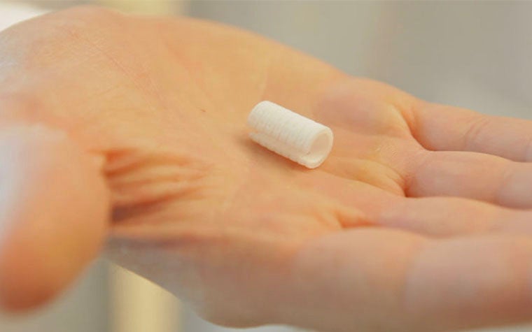 Hand holding a tiny 3D-printed splint