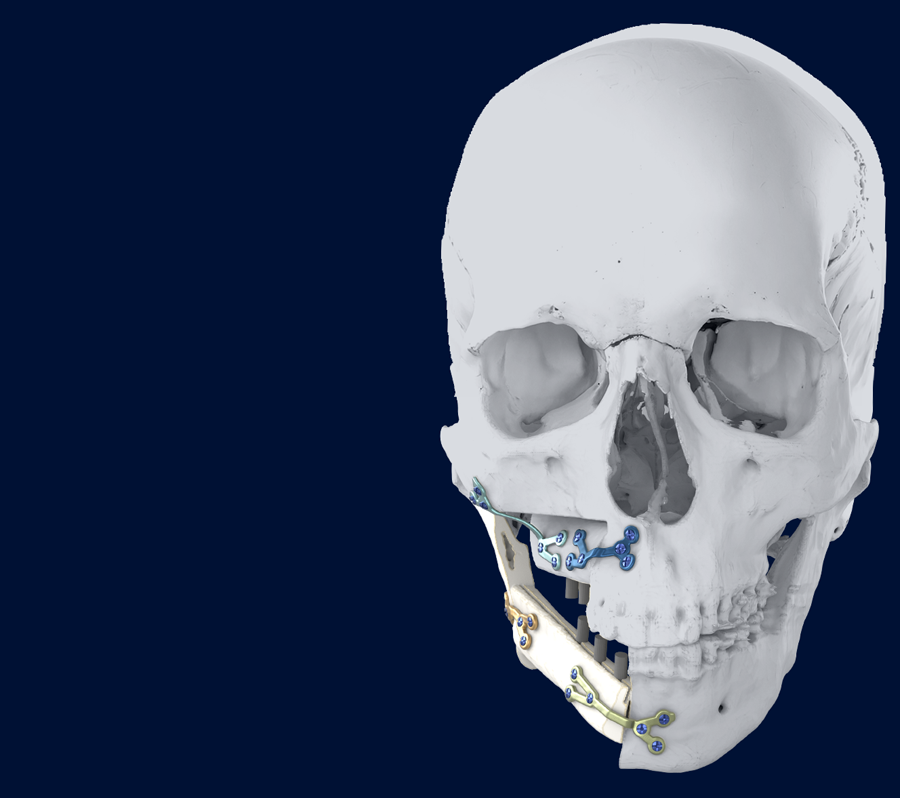 Reconstructive surgery