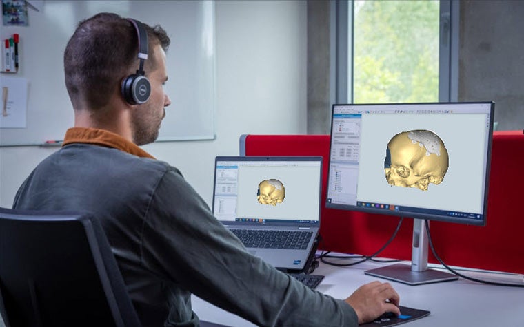 A man wearing headphones sitting at a desk with two computers and the Mimics Enlight CMF software open and a skull shown on both screens. 