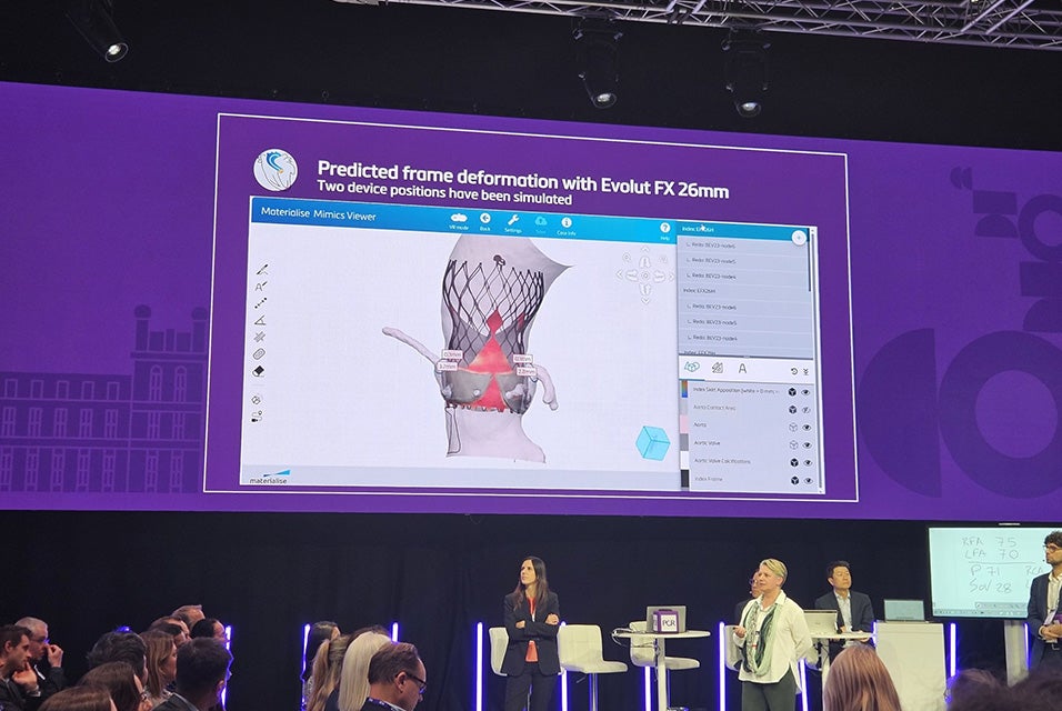 A group of people, including Dr. Wykrzykowska, standing on stage at PCR London Valves 2025 in front of a live audience, with a presentation on the screen behind her. The screen shows text saying "Predicted frame deformation with Evolut FX 22 mm."