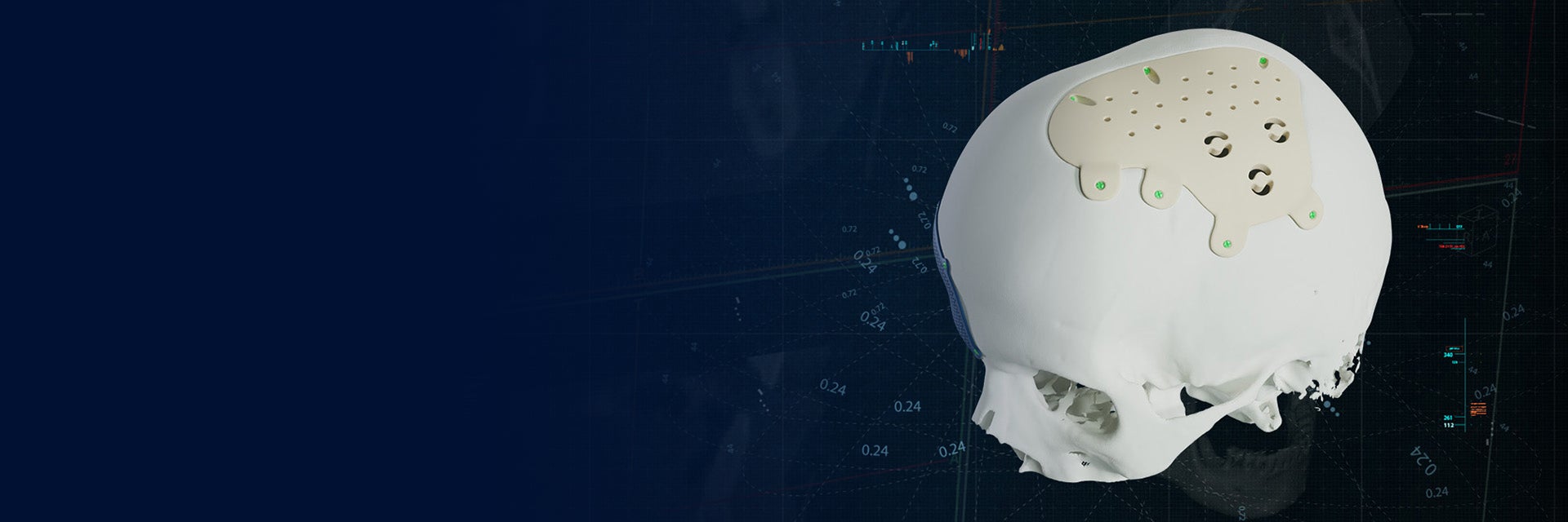 A white skull with a Materialise CMF PEEK implant on a blue background.