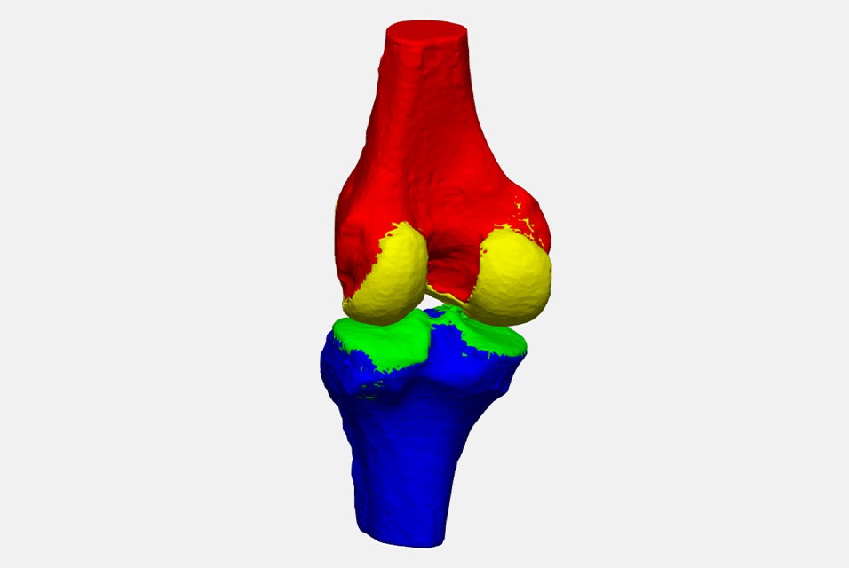 A 3D model of a segmented knee anatomy