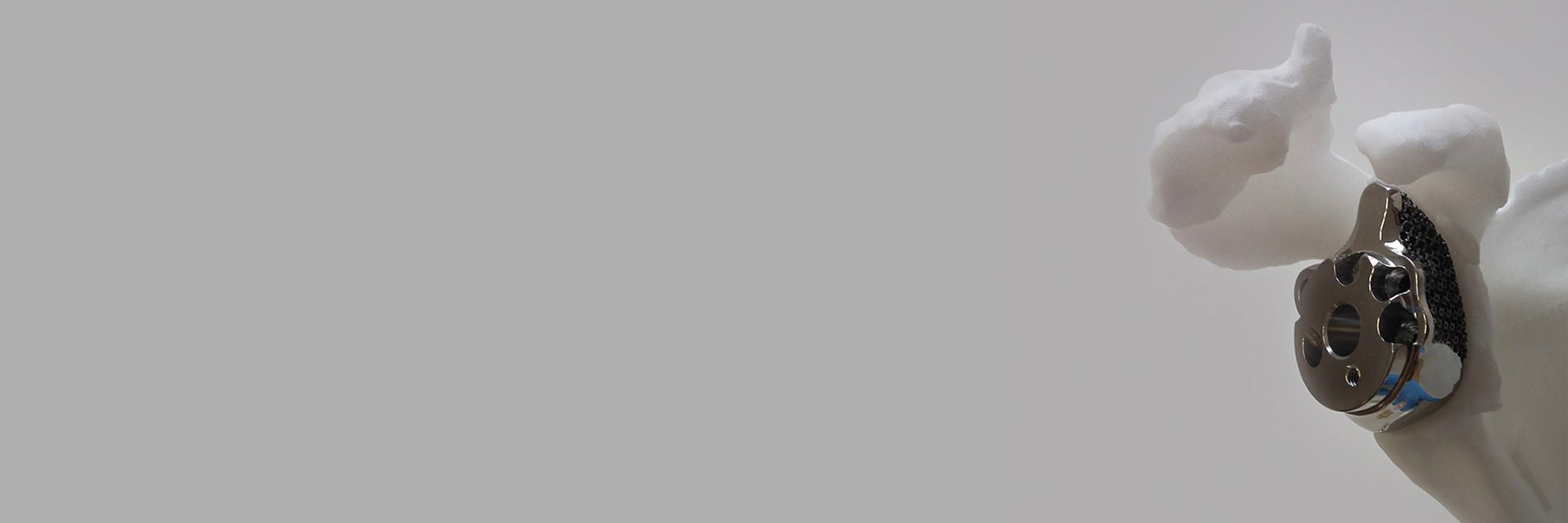 3D-printed, personalized implant in a shoulder model