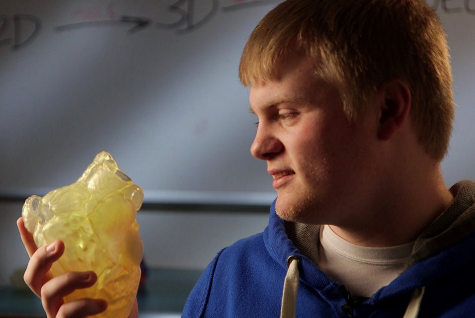 Heart tumor patient Bradley White holding his 3D-printed heart model 
