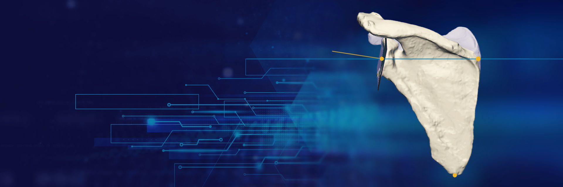 Shoulder bone with implant floating on a varied blue background