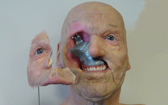 Anaplastology model presented by Jan De Cubber