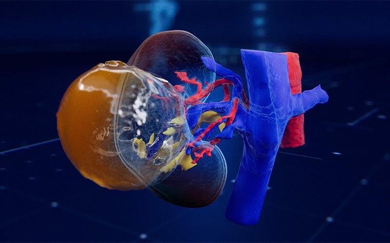 Transparent 3D rendering of a human kidney and surrounding blood vessels, with red and blue vascular structures visible against a dark blue background.