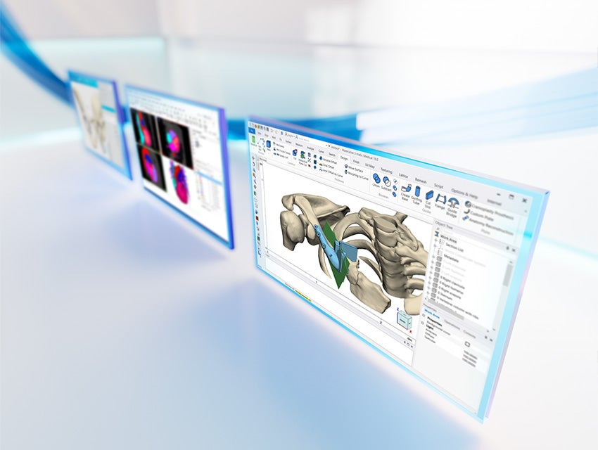 Trois écrans montrant l'anatomie du patient dans le logiciel de la plateforme Materialise Mimics sur un fond blanc réfléchissant avec des lignes bleues.