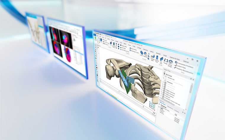 Trois écrans montrant l'anatomie du patient dans le logiciel de la plateforme Materialise Mimics sur un fond blanc réfléchissant avec des lignes bleues.