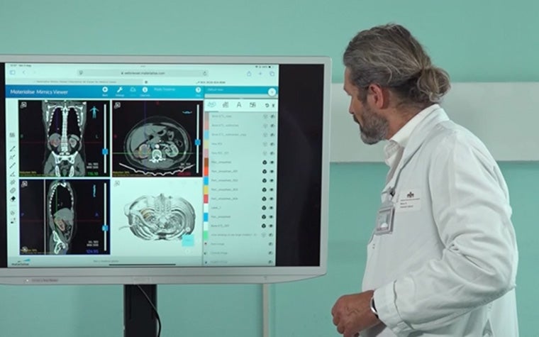 A medical professional in a white lab coat standing beside a large monitor displaying 3D anatomical scans and cross-sectional medical images using the Materialise Mimics Viewer software.