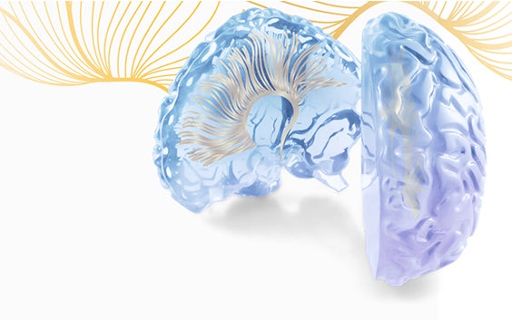 Translucent, 3D-printed brain model in front of yellow abstract lines