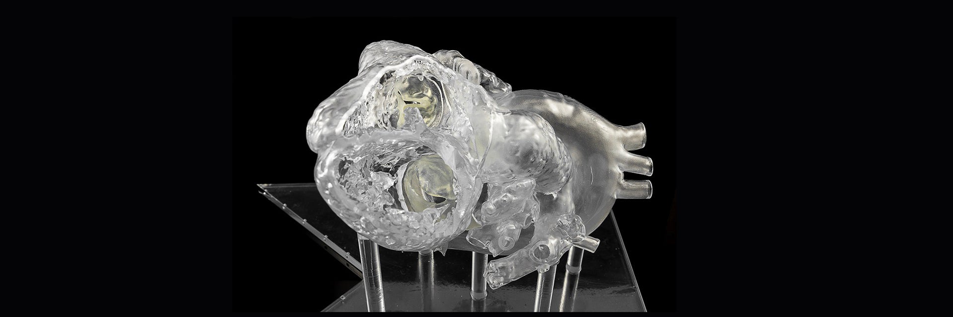 Transparent, 3D-printed heart model on stilt-like structures
