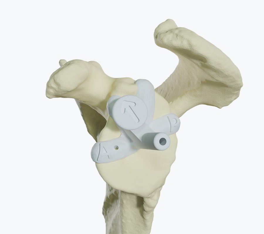 Glenoid rim fit