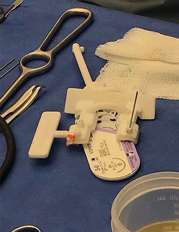 手の移植に使用するプランニングとガイド