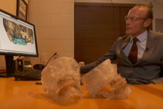 Dr. Goodisson demonstriert die ProPlan-Software und zeigt die Modelle, die er zur Planung des chirurgischen Eingriffs verwendet hat.