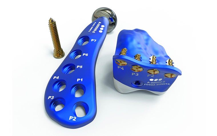 Engimplan implants and screws