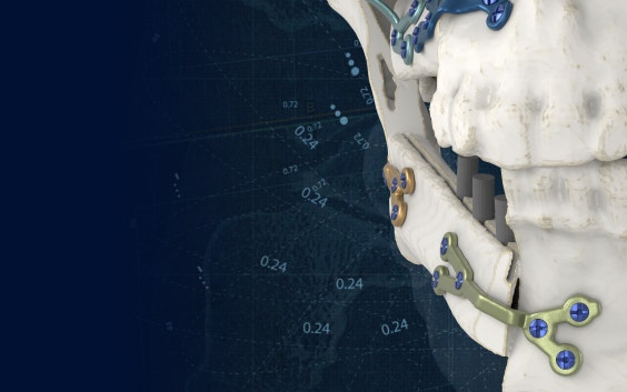 Reconstructive Surgery | Cranio-Maxillofacial Solutions | Materialise