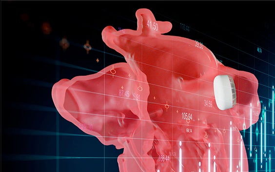 Digital visual of the Mimics Enlight LAAO Planner 