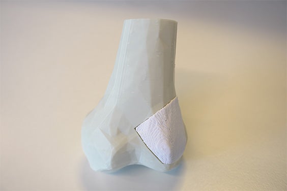 3d-printed-bone-model-implant.jpg