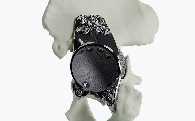 aMace hip implant in a bone model
