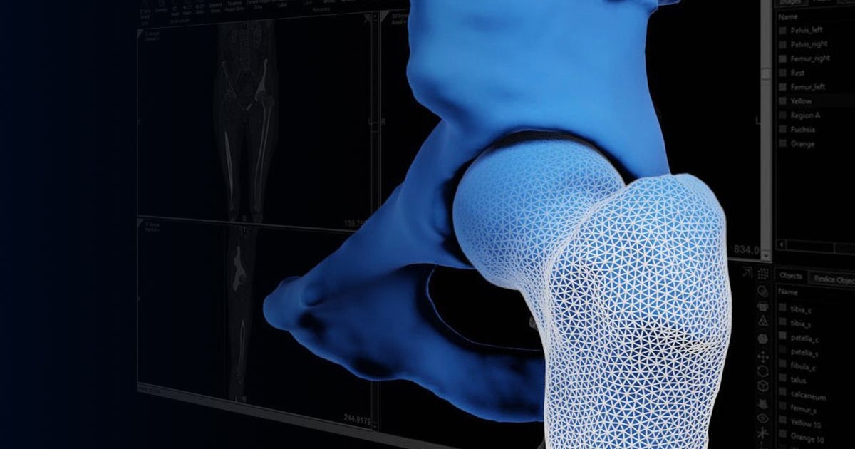 3Dプリントされたベンチトップモデル | アカデミア向けのMaterialise 