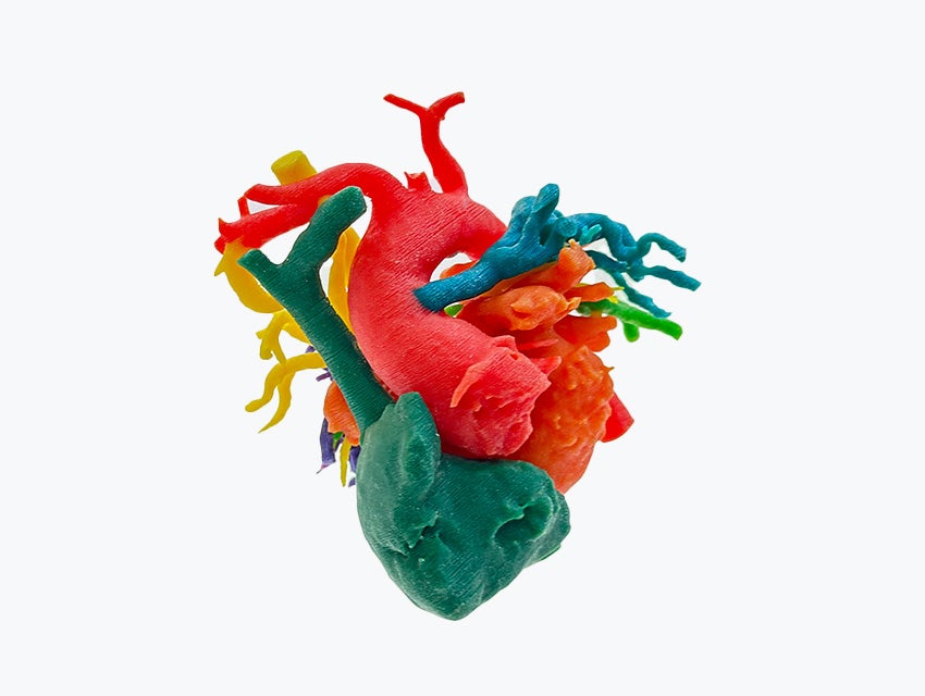 ssd-3d-printed-heart-model-front.jpg