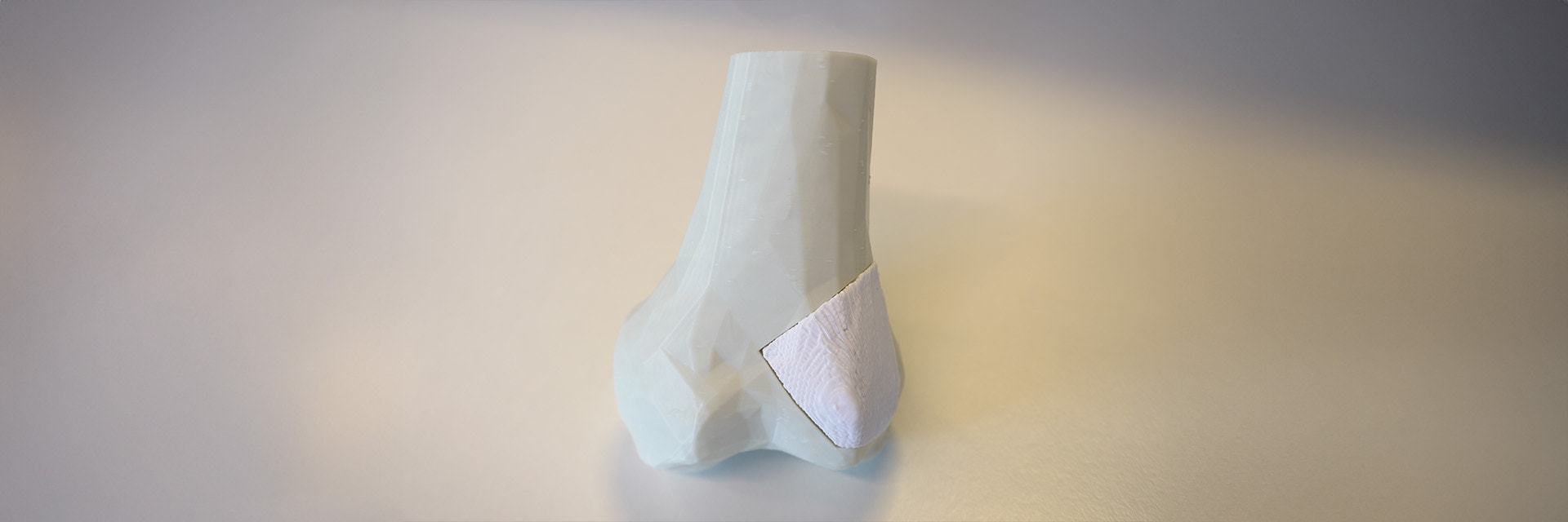 Ossiform Creates Patient-Matched Bone Implants with 3D Printing