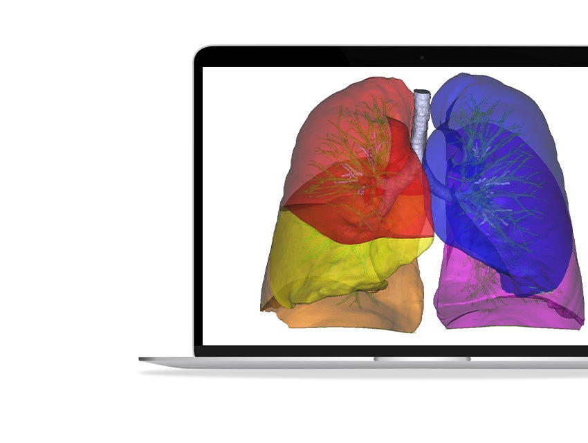 ssd-lung-scan-3d-model-respiratory-imaging.jpg