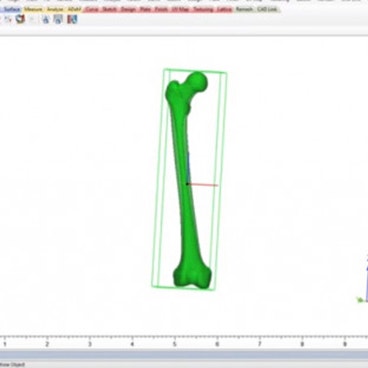 Statistical Shape Model Bone Anatomical Analysis for Academia | Materialise Mimics