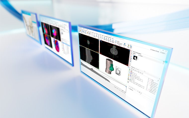 Tres pantallas que muestran la anatomía del paciente dentro del software de la plataforma Materialise Mimics sobre un fondo blanco reflectante con líneas azules.