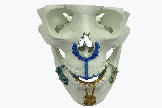 skull-cmf-morye-tooth-sup-3d-printed-guides-render.jpg