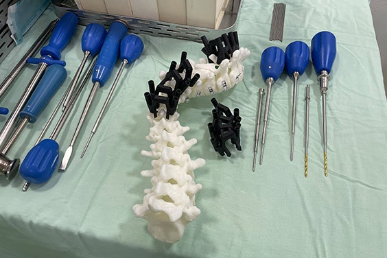 Modelo impreso en 3D de la columna vertebral del paciente y guías impresas en 3D colocadas en la mesa quirúrgica junto a las herramientas quirúrgicas.