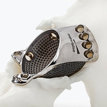  Surgical Technique: aMace