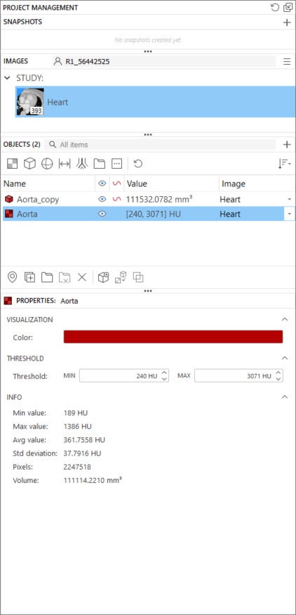 Screenshot from Mimics software