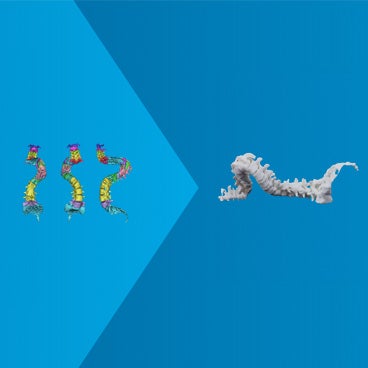 脊椎治療のイノベーション — パーソナライゼーションで他社と差を