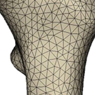 How to Prepare a Bone Model for FEA