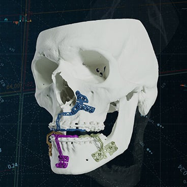 Mastering MIOS: Clinical Insights, Tips and Tricks, and Real Cases  