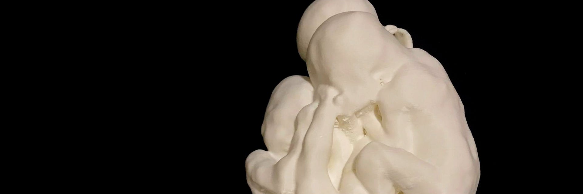 A 3D-printed model of twin fetuses 