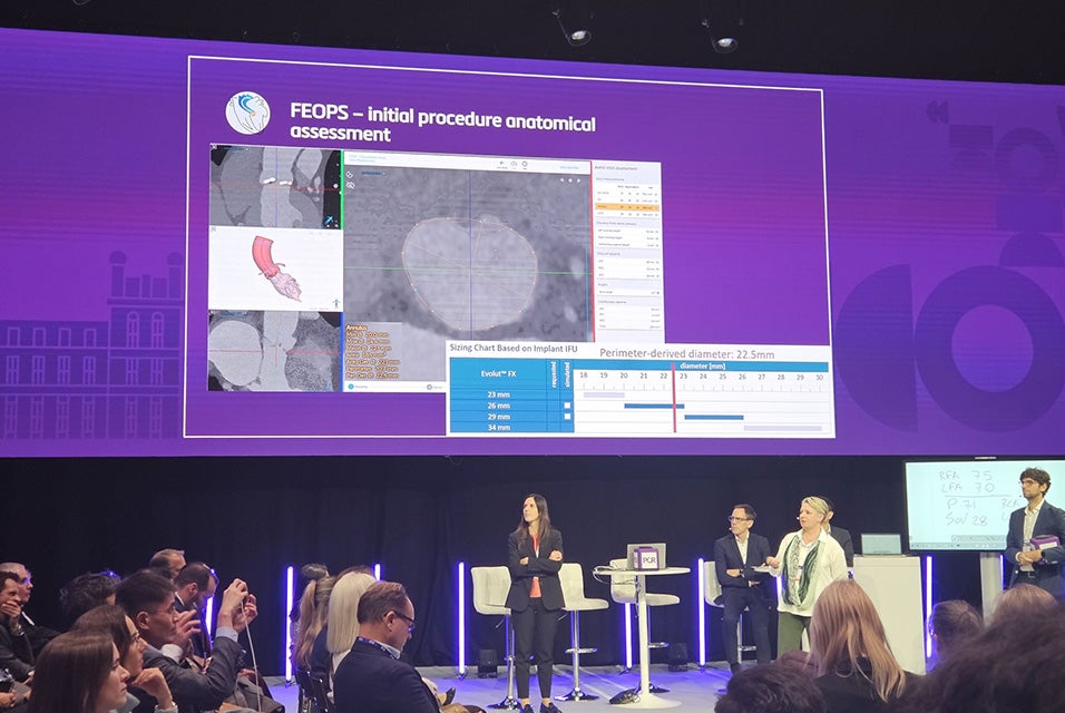 A group of people, including Dr. Wykrzykowska, standing on stage at PCR London Valves 2025 in front of a live audience, with a presentation on the screen behind her. The screen shows text saying "FEOPS - initial procedure anatomical assessment."