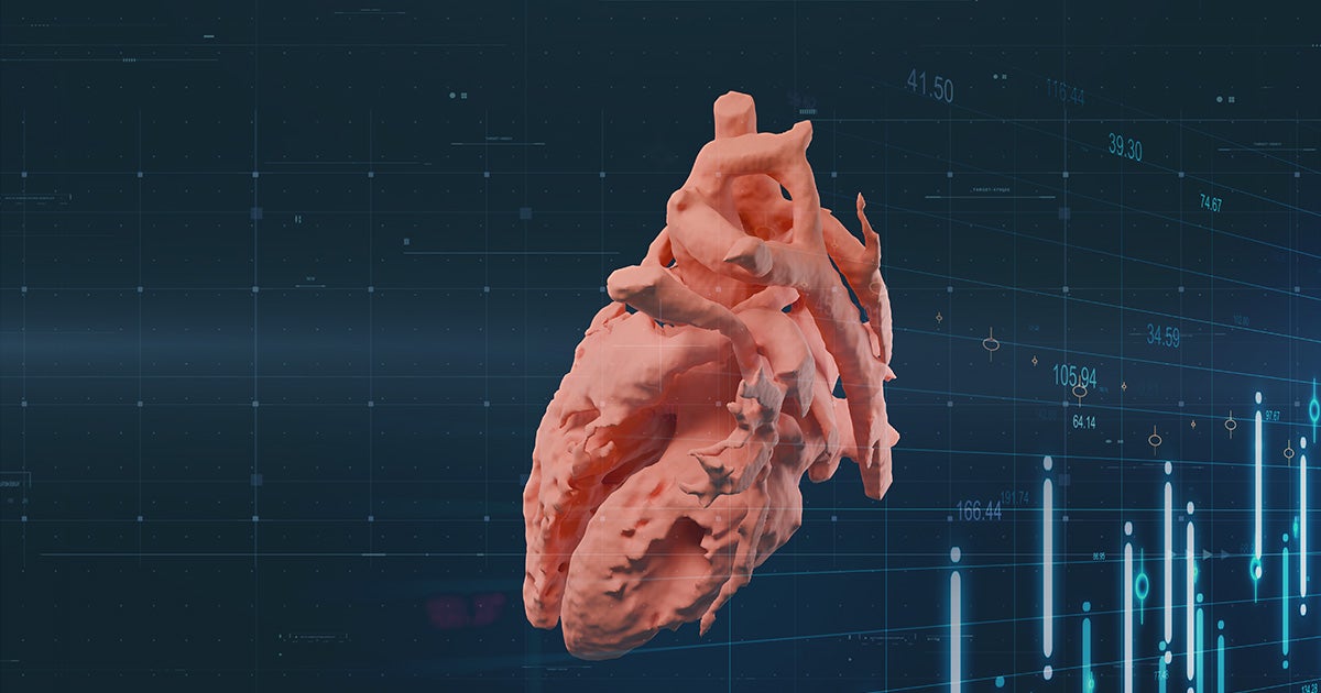 og-congenital-heart-disease-