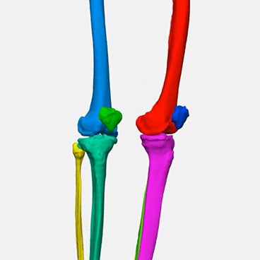Versatility in Mimics: 3 Ways to Segment Bones