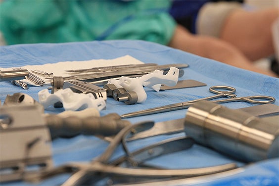 Personalisierte Knieführungen und medizinische Instrumente, die für die Operation ausgelegt sind