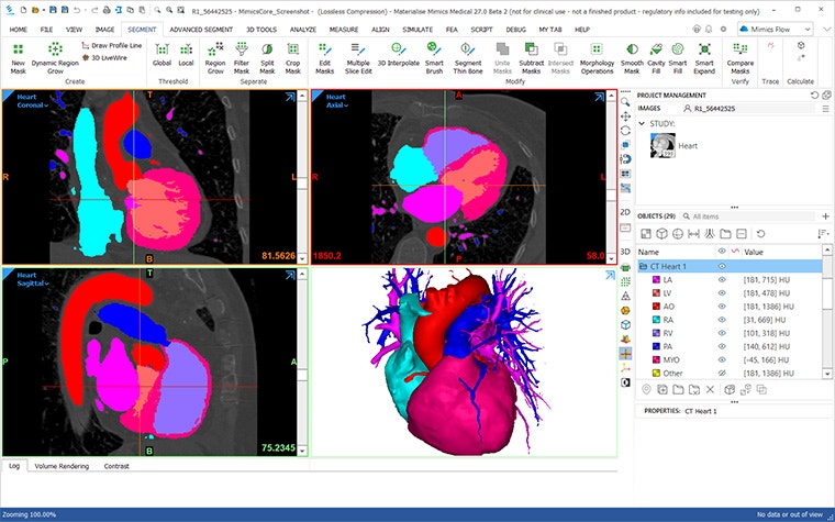 A screenshot of an anatomical heart in Mimics Core.