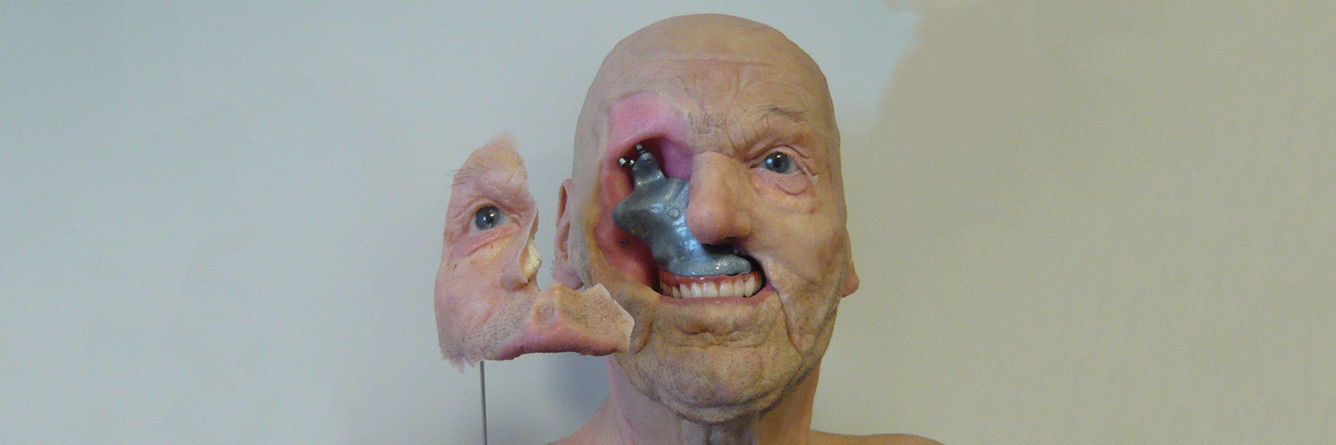 Anaplastology model presented by Jan De Cubber